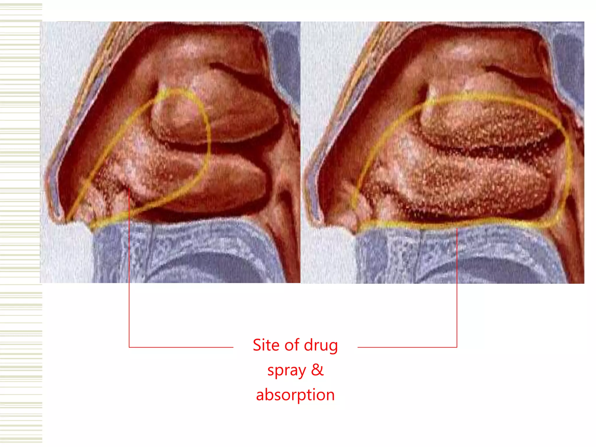 Intranasal drug delivery system | PPTX