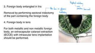 3. Foreign body entangled in Iris
Removal by performing sectoral iridectomy
of the part containing the foreign body
4. Foreign body in lens
For both metallic and non metallic foreign
body, an extracapsular cataract extraction
(ECCE) with intraocular lens implantation
should be performed.
Peripheral
iridectomy
OPB
Also done in
glaucoman procedie; laser used
trabeculectory
 