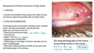 Management of Retained Intraocular Foreign Bodies
1. HISTORY
A careful and detailed history about the mode of injury
can tell you about the possible type of foreign body
2. OCULAR EXAMINATION
A thorough ocular examination including vision, pinhole
vision, slit lamp examination, should be done.
Signs you can look out for are:
- Subconjunctival hemorrhage
- Corneal scar
- Holes in the iris
- Opaque track through lens
- IOFB lodges in the angle of anterior chamber can be
seen on gonioscopy
- With clear media sometimes IOFB can be seen with
ophthalmoscopy in the vitreous.
seen as redness in Schere
due to perforation
ISG B scow: Retina
imaging SRK
faumda
US
I A scan: IntraocularLens
 