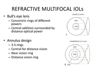 Multifocal Power Rings Intraocular lenses | PPTX