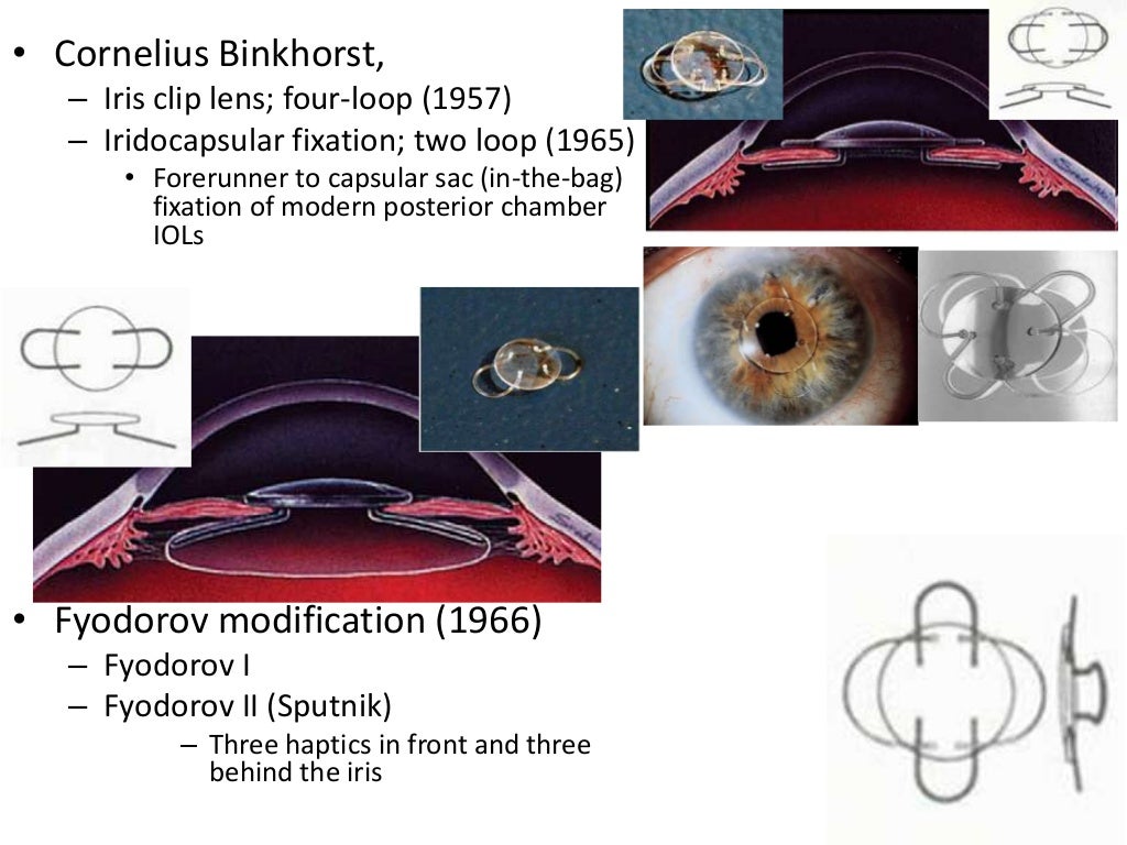 Intraocular lenses