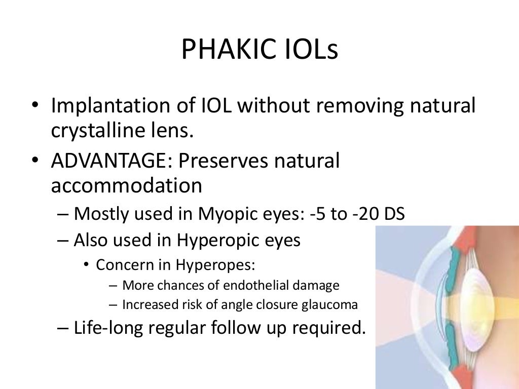 Intraocular lenses