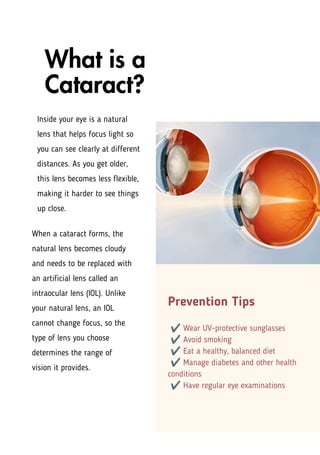 Guide to Intraocular Lens Options for Cataract Surgery | PDF