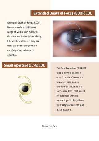 Guide to Intraocular Lens Options for Cataract Surgery | PDF