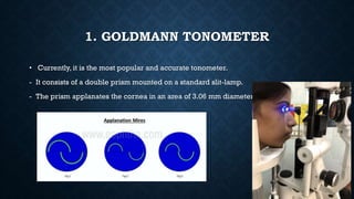1. GOLDMANN TONOMETER
• Currently, it is the most popular and accurate tonometer.
- It consists of a double prism mounted on a standard slit-lamp.
- The prism applanates the cornea in an area of 3.06 mm diameter.
 