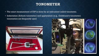 TONOMETER
• The exact measurement of IOP is done by an instrument called tonometer.
• Indentation (Schiotz tonometer) and applanation (e.g., Goldmann’s tonometer)
tonometers are frequently used
 