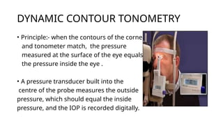 INTRAOCULAR PRESSURE INTRODUCTION AND MEASUREMENT | PPTX