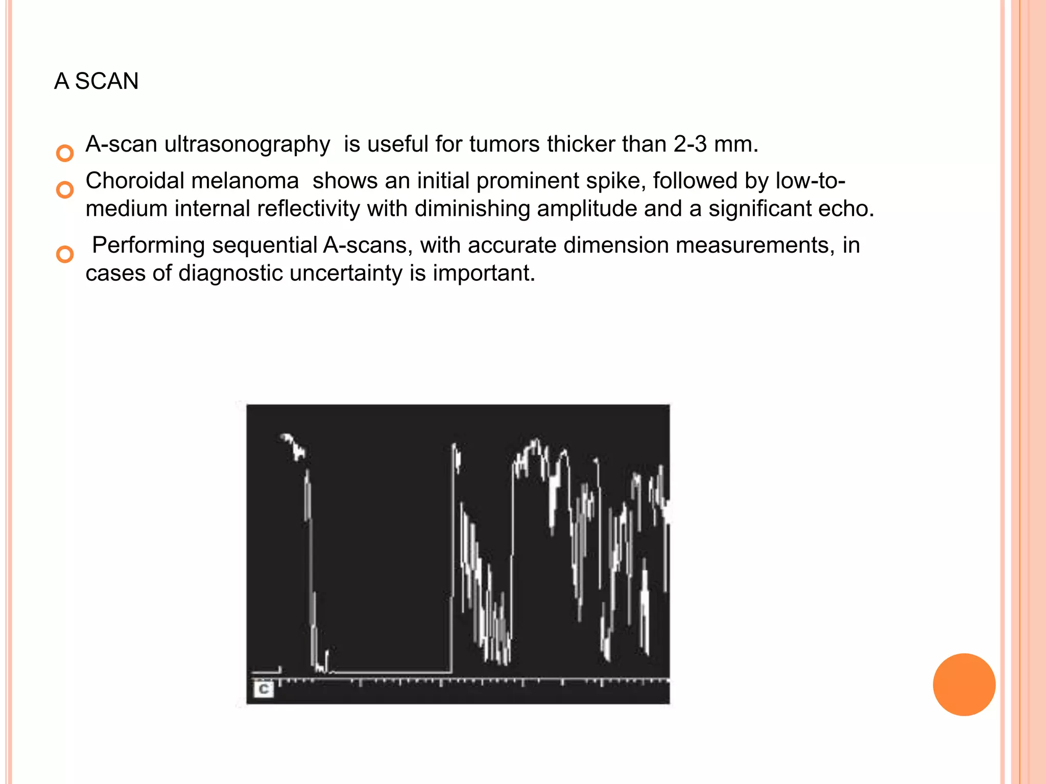 A SCAN
 A-scan ultrasonography is useful for tumors thicker than 2-3 mm.
 Choroidal melanoma shows an initial prominent spike, followed by low-to-
medium internal reflectivity with diminishing amplitude and a significant echo.
 Performing sequential A-scans, with accurate dimension measurements, in
cases of diagnostic uncertainty is important.
 