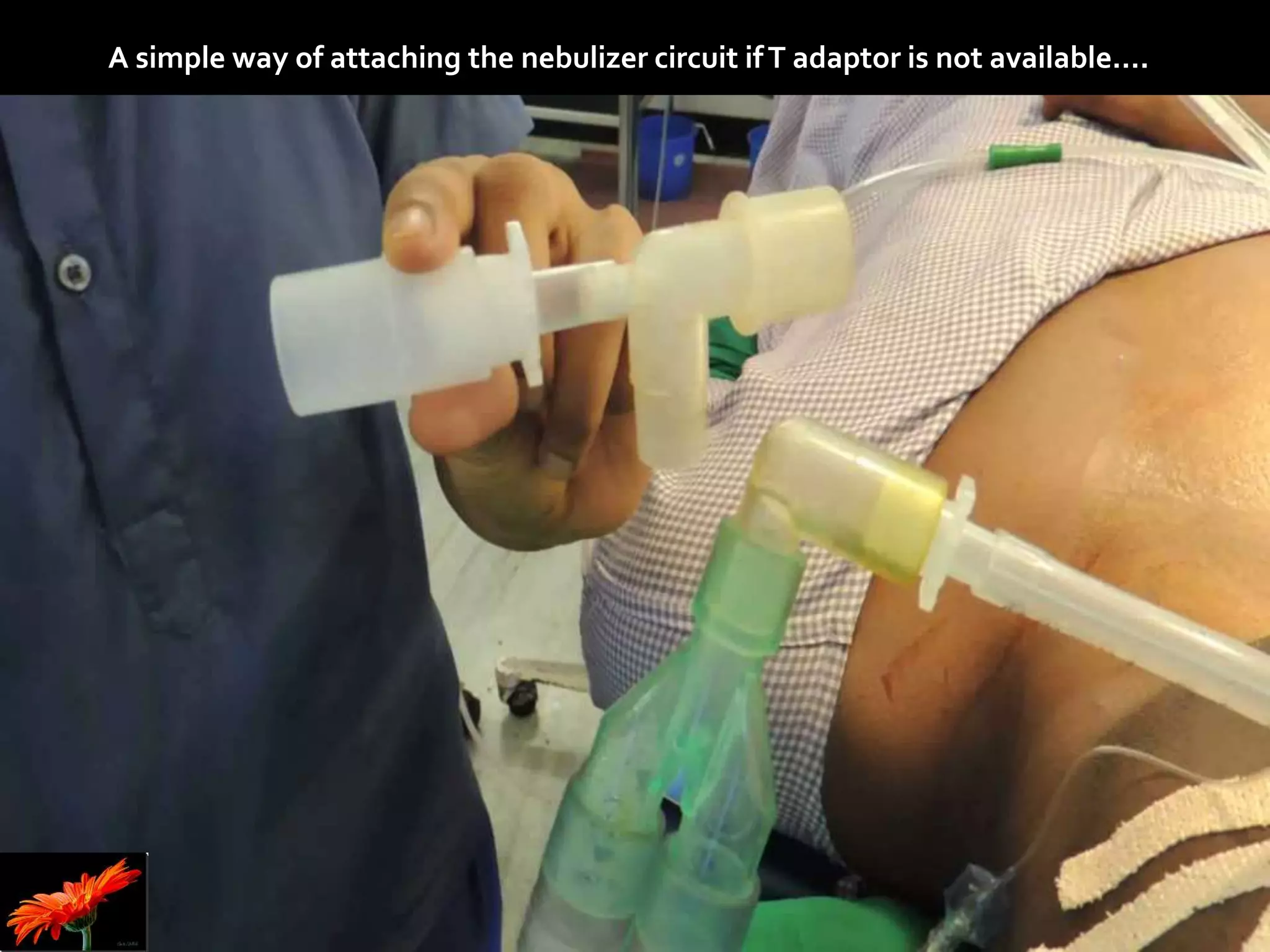 A simple way of attaching the nebulizer circuit ifT adaptor is not available….
 