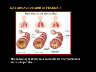 Intraoperative bronchospasm | PPTX