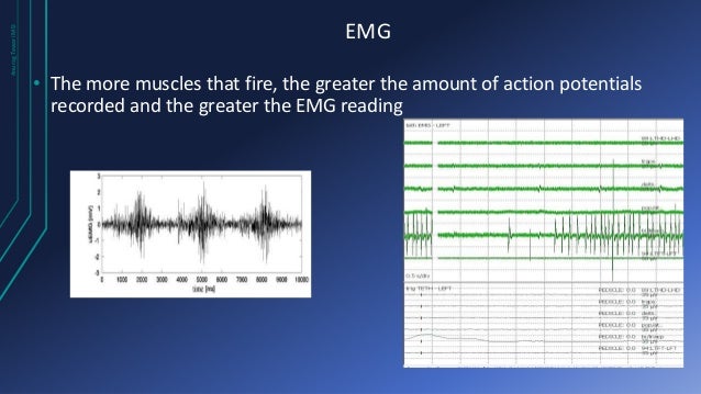 Intraoperative Electromyography (EMG)