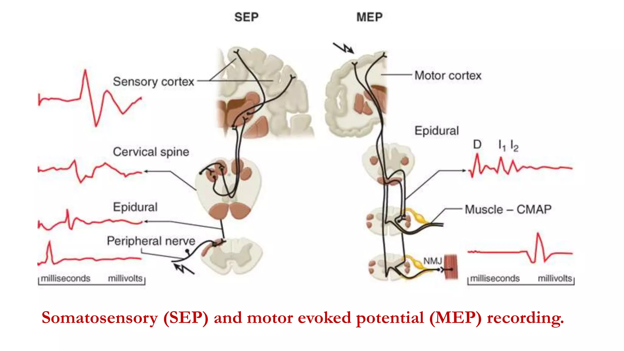 Somatosensory (SEP) and motor evoked potential (MEP) recording.
 
