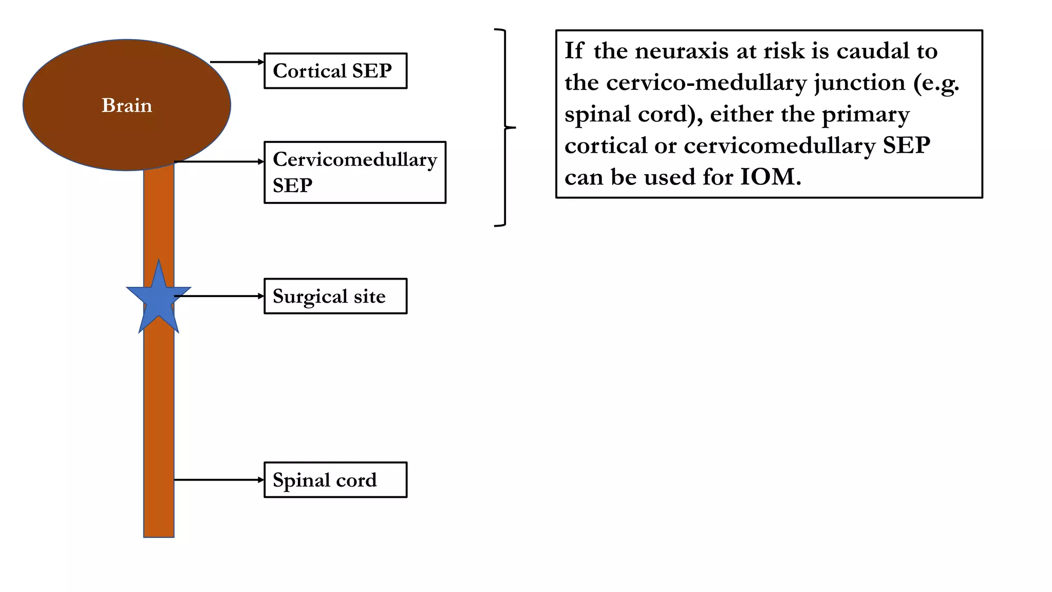 Brain
Cortical SEP
Cervicomedullary
SEP
Surgical site
Spinal cord
If the neuraxis at risk is caudal to
the cervico-medullary junction (e.g.
spinal cord), either the primary
cortical or cervicomedullary SEP
can be used for IOM.
 