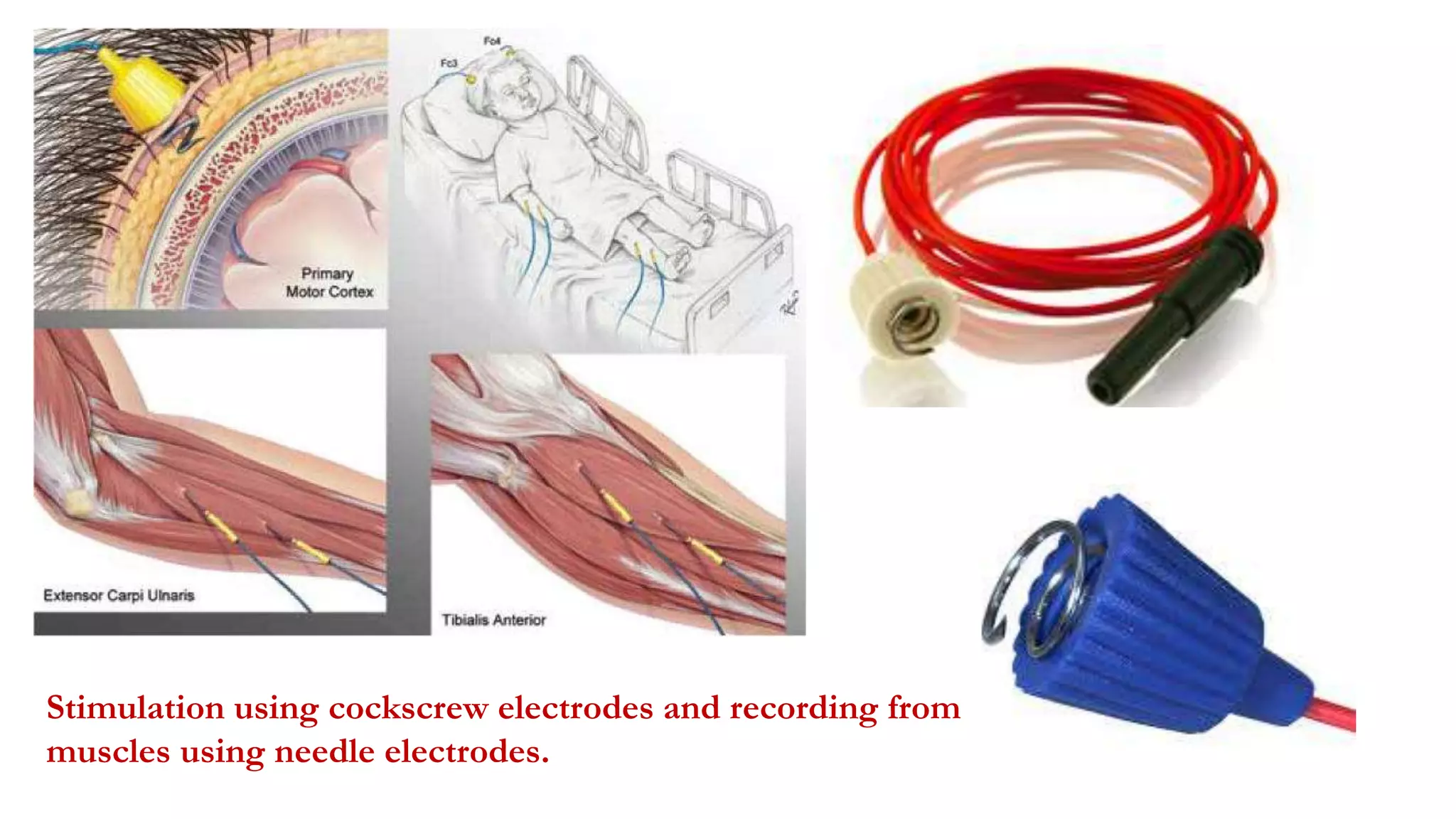 Stimulation using cockscrew electrodes and recording from
muscles using needle electrodes.
 
