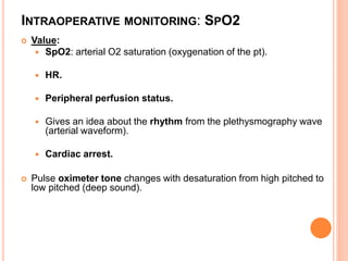 Spo2 Improper Wave Form Intraoperative Monitoring. sandeep. first years.ppt