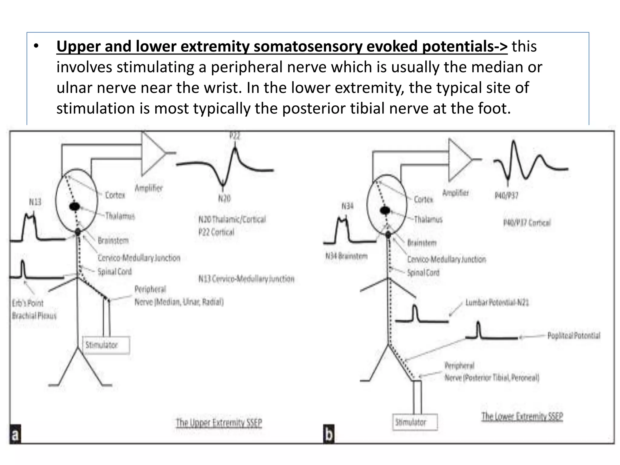 Intraoperative neurophysiologic monitoring of the spine | PPTX | Brain ...