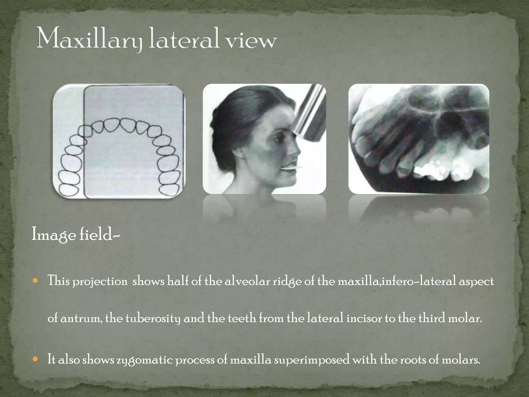 6. Intraoral Radiographic Techniques – AVKIU
