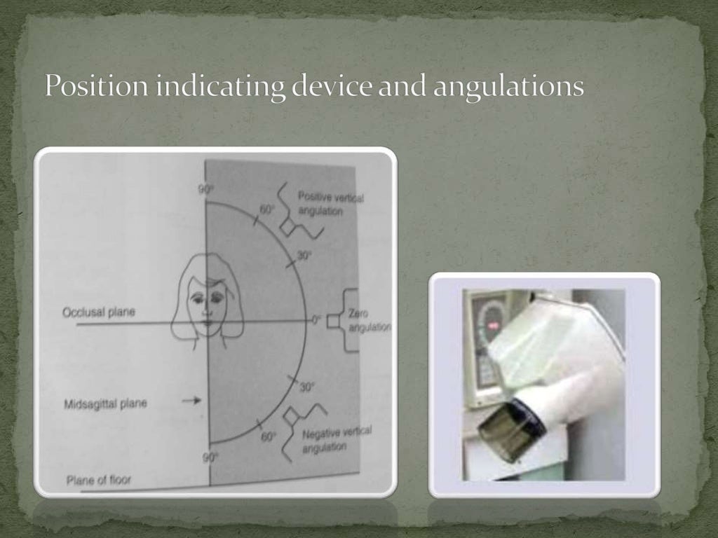 Intraoral radiographic technique ii