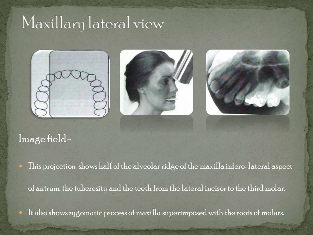 Intraoral radiographic technique ii