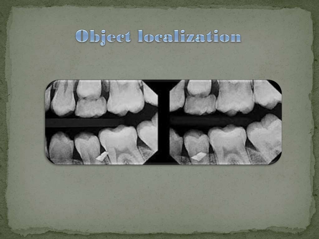 Intraoral radiographic technique ii