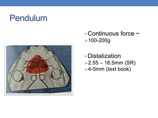 Pendulum
• Continuous force ~
100-200g
• Distalization
2.55 – 18.5mm (SR)
4-5mm (text book)
 