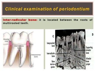 Interradicular Inection Intra oral examination | PPTX