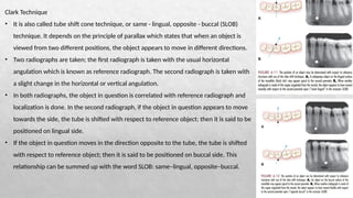 INTRAORAL IMAGING TECHNIQUE, ORAL RADIOLOGY | PPTX