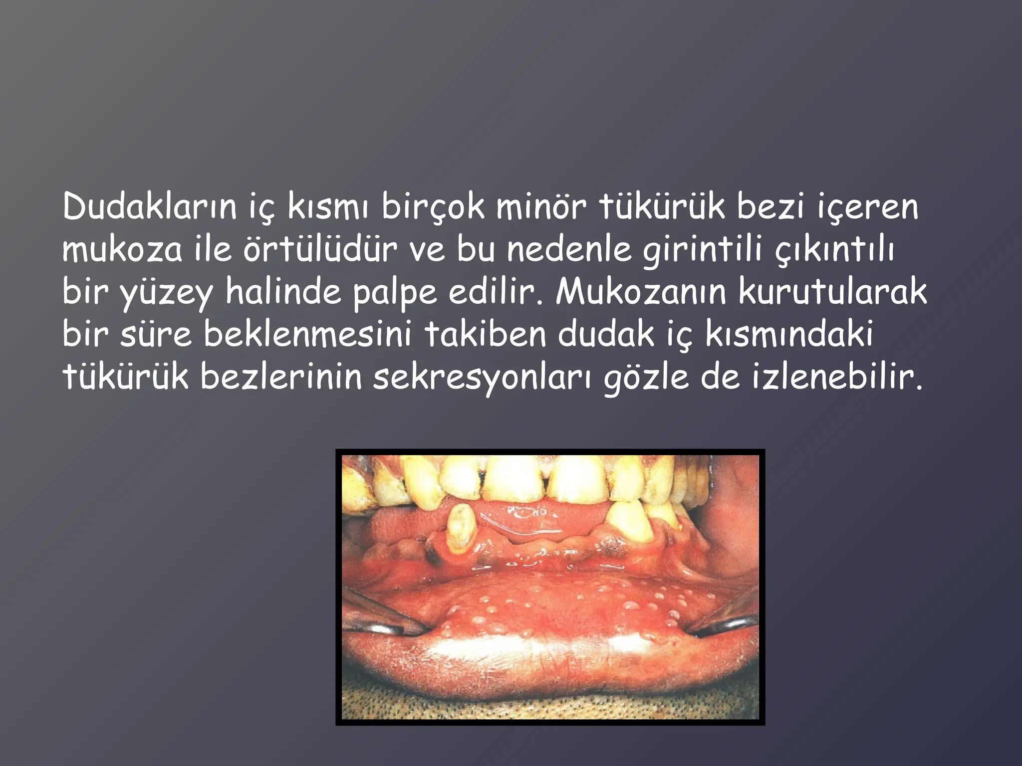 radyolojide-ntraoral-muayene-ve-hastaya-yakla-m-pdf