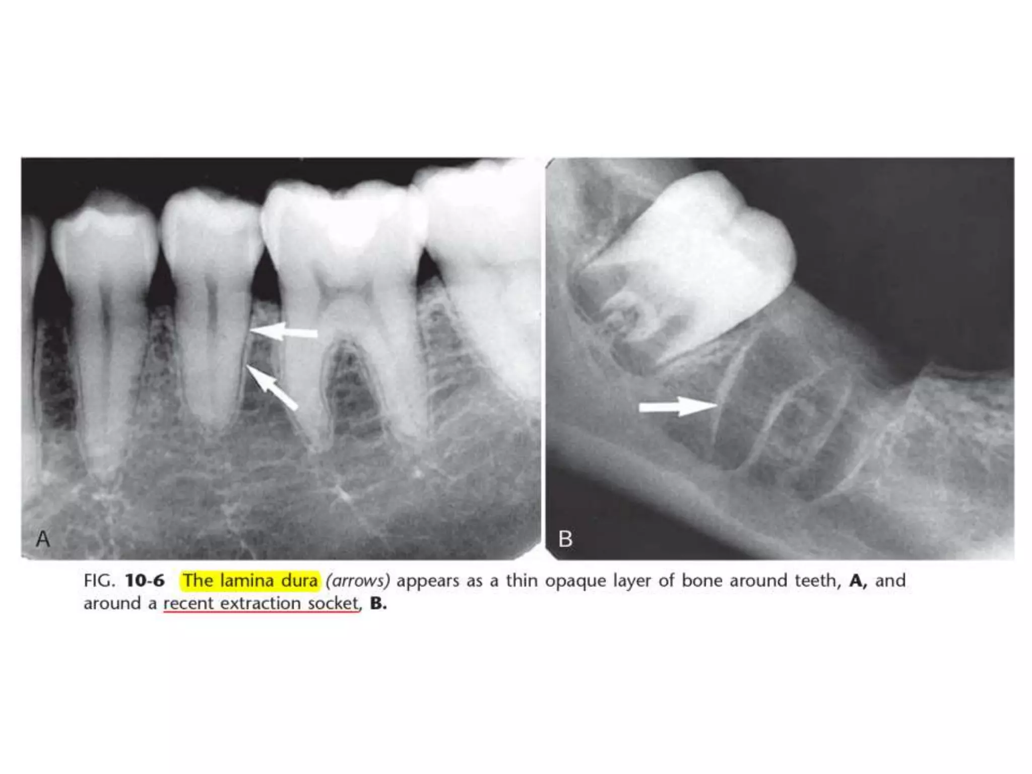 Intraoral radiographic anatomy | PPTX