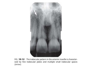Intraoral radiographic anatomy