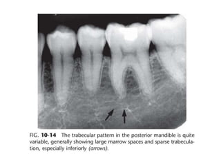 Intraoral radiographic anatomy