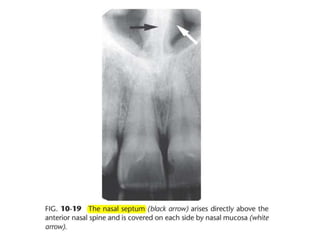 Intraoral radiographic anatomy