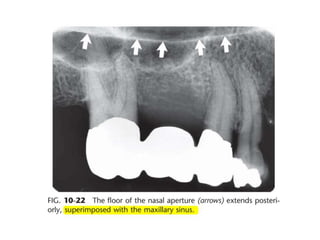 Intraoral radiographic anatomy