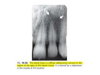 Intraoral radiographic anatomy