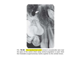Intraoral radiographic anatomy