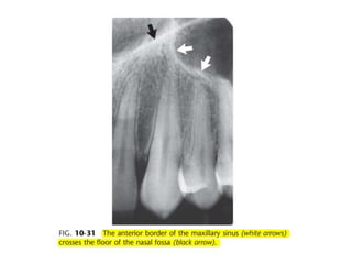 Intraoral radiographic anatomy