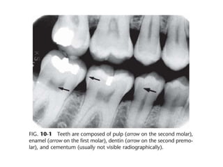 Intraoral radiographic anatomy