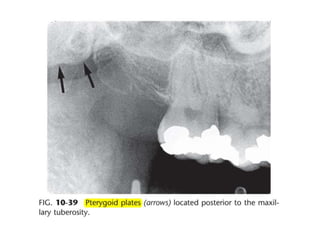 Intraoral radiographic anatomy