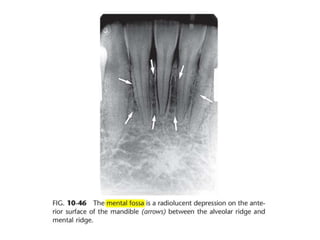 Intraoral radiographic anatomy