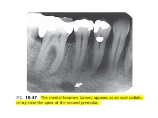 Intraoral radiographic anatomy