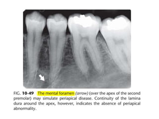 Intraoral radiographic anatomy
