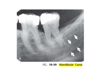 Intraoral radiographic anatomy