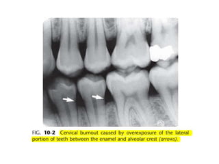 Intraoral radiographic anatomy