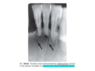 Intraoral radiographic anatomy