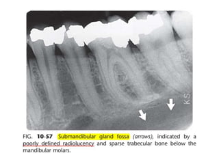 Intraoral radiographic anatomy