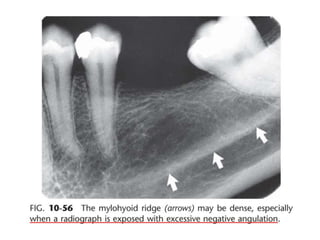 Intraoral radiographic anatomy