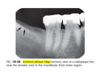 Intraoral radiographic anatomy