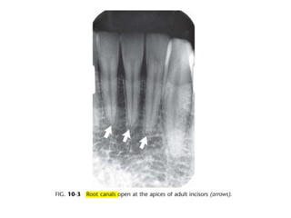 Intraoral radiographic anatomy