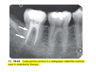 Intraoral radiographic anatomy