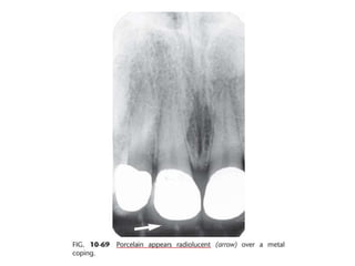 Intraoral radiographic anatomy
